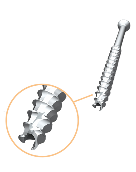 SCrew closeup base.png