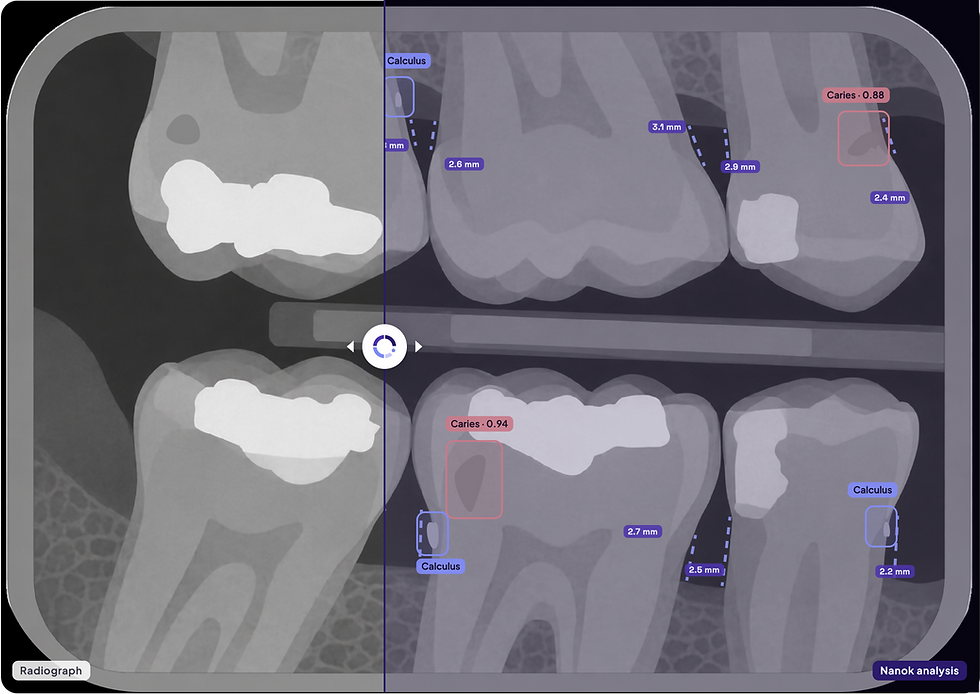 nanok-compare-slider.png