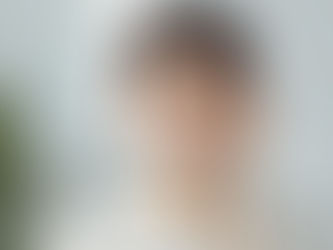 二重整形（切開法）後のまぶたのむくみ｜引くまでの期間と対応｜新宿インディバサロンForever