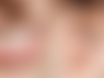 BRUXISMO: el rechinido nocturno de los dientes