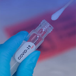 Prueba rápida de COVID-19 en el Hospital Escuela: resultado en 10 minutos