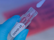 Prueba rápida de COVID-19 en el Hospital Escuela: resultado en 10 minutos