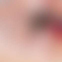 Secretaría de Salud refuerza acciones para frenar el dengue en el país