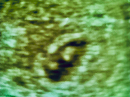 thank you for your patience