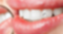 As-7-perguntas-mais-frequentes-sobre-piercing-dental02-1024x570.png