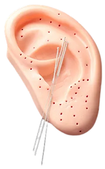 auriculoterapia