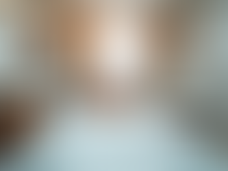 Transformations with Dermal Fillers: Effects of Dermal Fillers Before and After