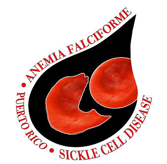 Anemia Falciforme