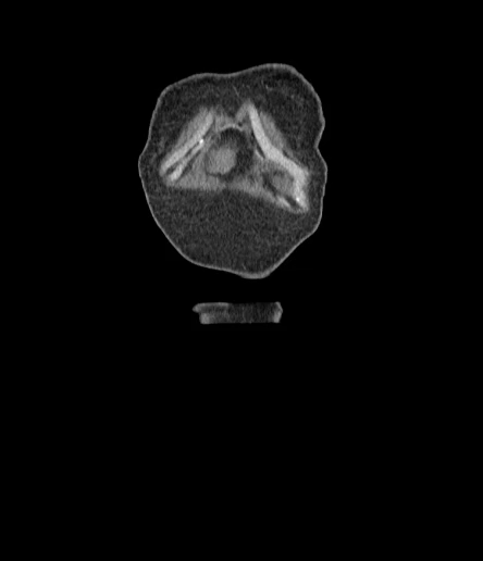 ezgif.com-gif-maker (2).gif