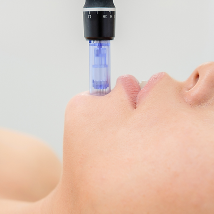 Close-up of a face in profile with a blue nasal suction device inserted in the nostril against a white background.