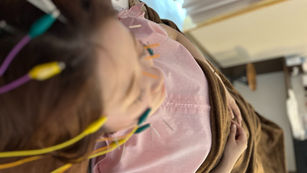 美容鍼と効果的なスキンケアの関係：美肌を手に入れるためのポイント