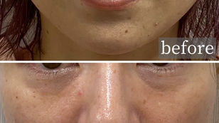 セラミドで強いお肌を作る。