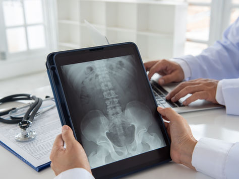SI Joint Dysfunction: Why Your Hip and Back Pain May Not Be Coming From Your Disc