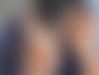 Indian man suffering from hair loss