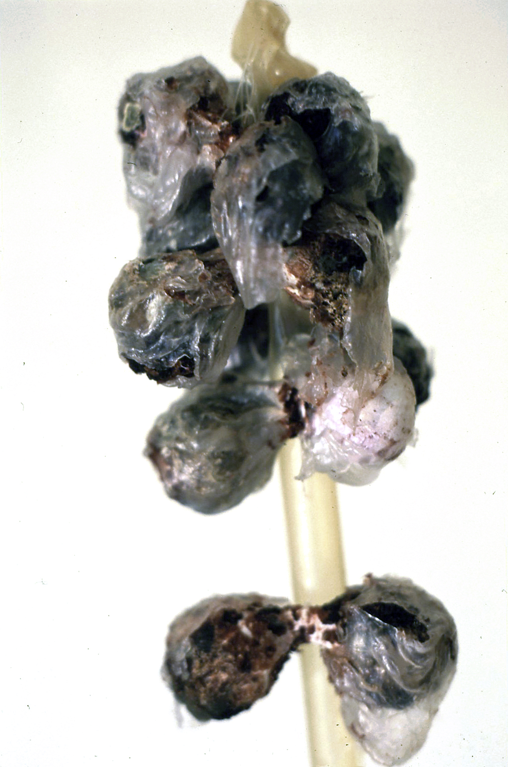 Neck Lump - detail