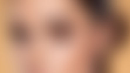 Unlocking the Secret to Youthful Eyebrows: Dr. Anil Shah's Innovative Brow Filler Technique