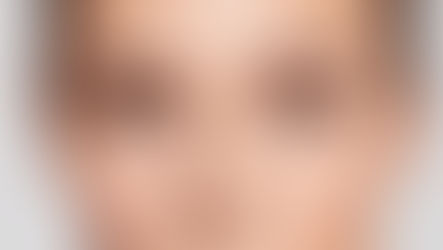 Combining Treatments: Under Eye Fillers with Other Procedures at Aesthetic Skin New York