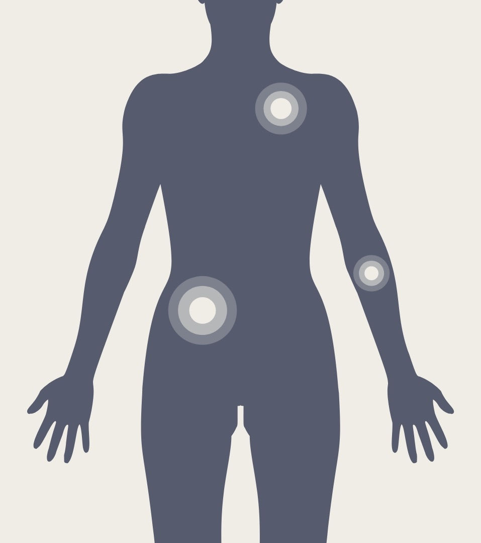 Female - Lumps + bumps (mobile).jpeg