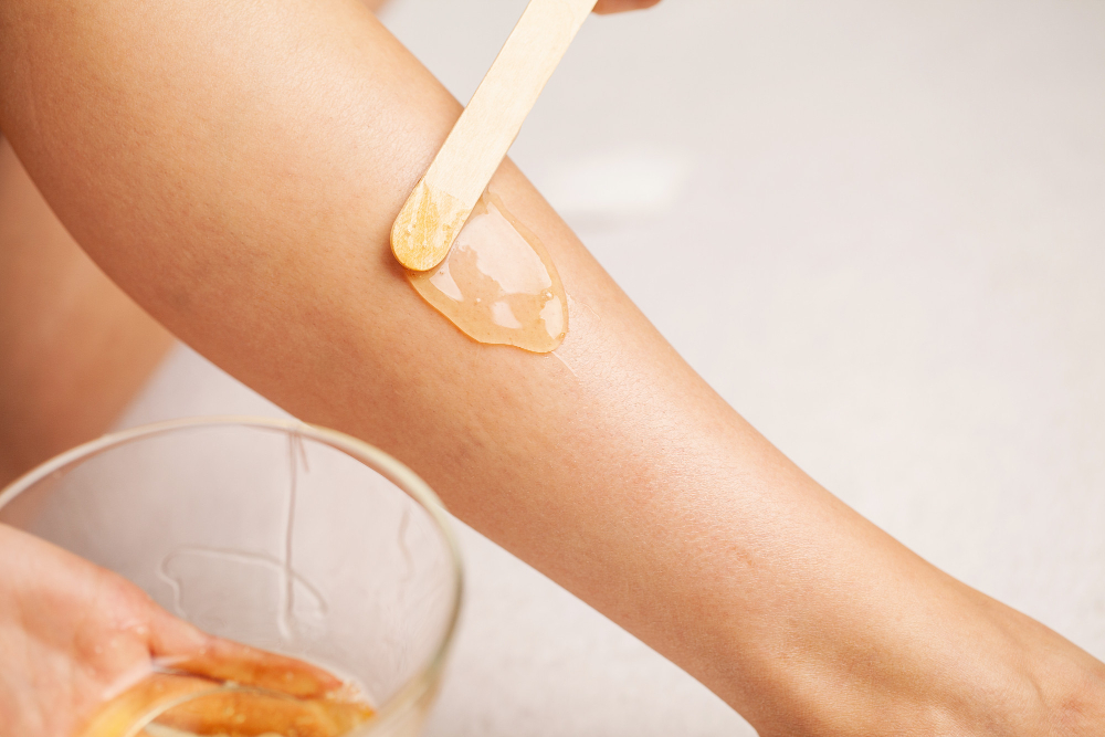 Cellulite Demystified