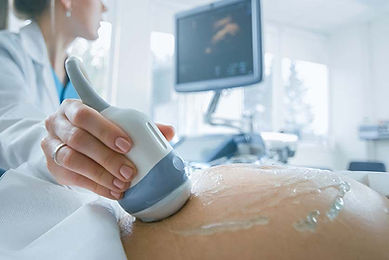 ECODOPPLERCARDIOGRAMA