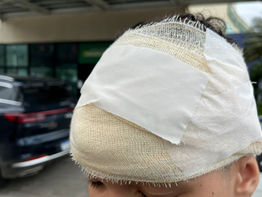 DOIS JOVENS FORAM ESFAQUEADOS NO PÁTIO DE EVENTOS DE CARUARU