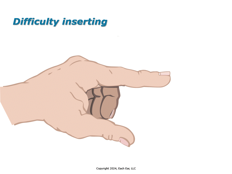Insertion diff and Retrofit_1.gif