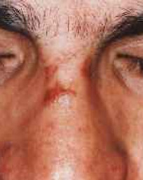 nose1.jpg