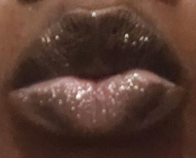 Miniature : Lipgloss Ultra Rimpolpante