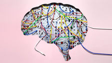 Rewiring the Brain