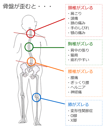 骨盤.gif