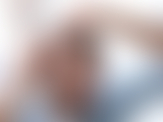 Is Hair Transplant Effective for Bald Patches