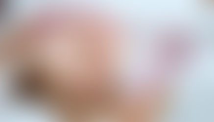 Is RF Microneedling Safe for All Skin Types