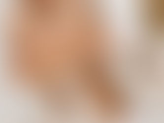 Is Profhilo Treatment Safe for Face?