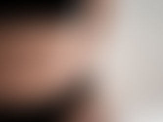 What Areas Can Liposuction Surgery Treat Safely?