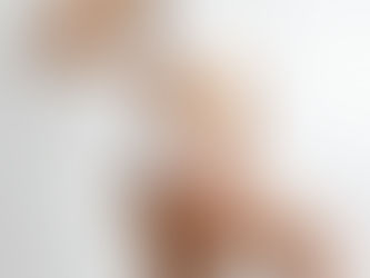 Is Body Fillers Treatment Safe for Curves