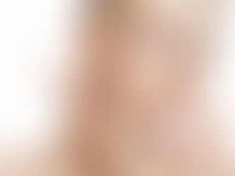 How Exosome Therapy Cost Varies by Treatment