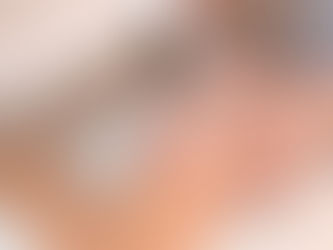 Is CO2 Laser Safe for Skin Resurfacing