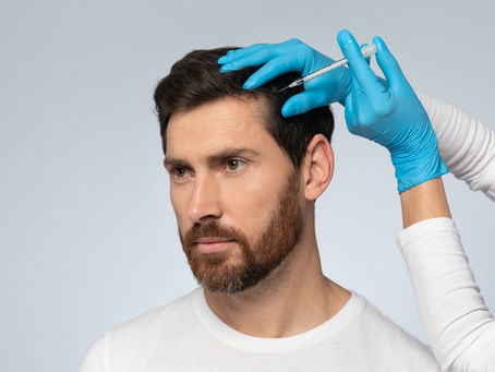 Is PRP Hair Treatment Safe for Hair Loss?