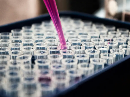 Exame para diagnóstico de Alzheimer ganha destaque em estudo brasileiro