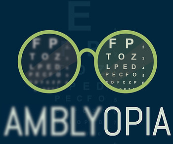 amblyopia graphic.jpeg