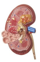 Understanding End-Stage Renal Disease (ESRD): Causes, Symptoms, and Treatment