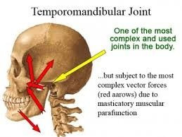 Jaw pain