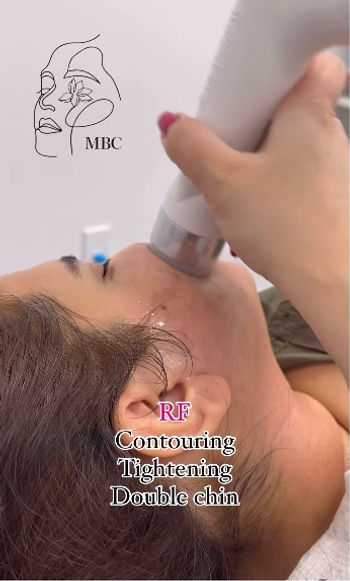 What is Radiofrequency Skin Tightening