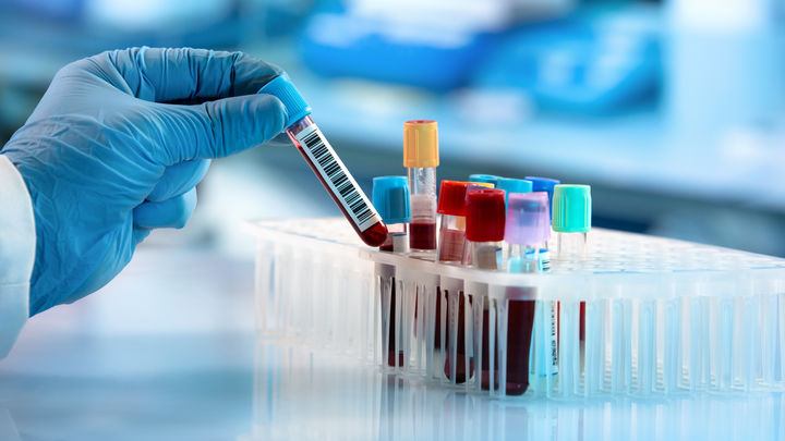 Lab Testing
