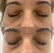 Reejuvenate - Plasmaa Results