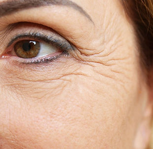 Fine lines & Wrinkles.jpg