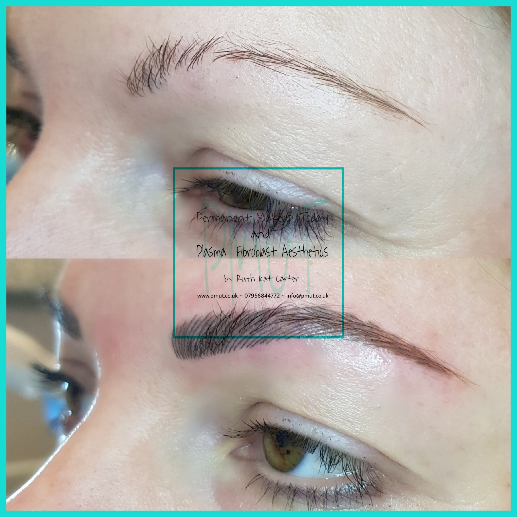 Brows Procedure