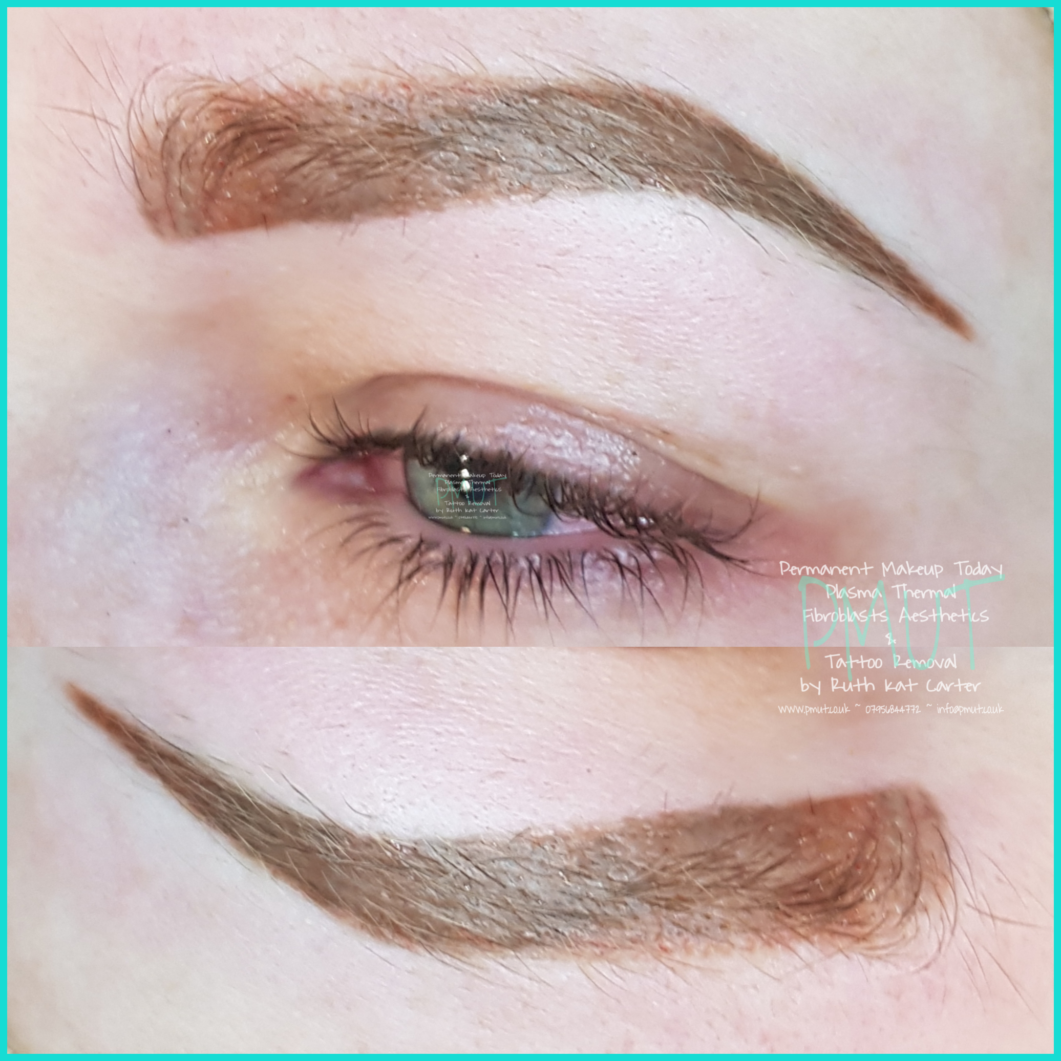 Brows Procedure