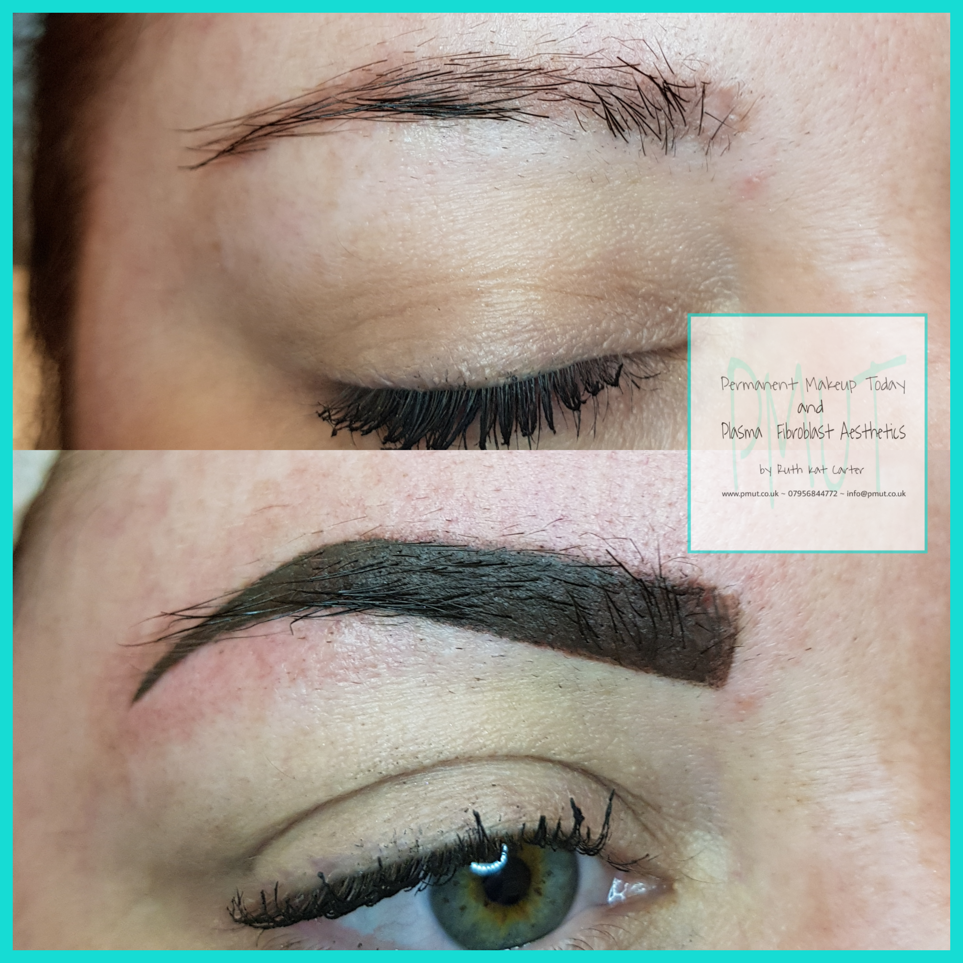 Brows Procedure