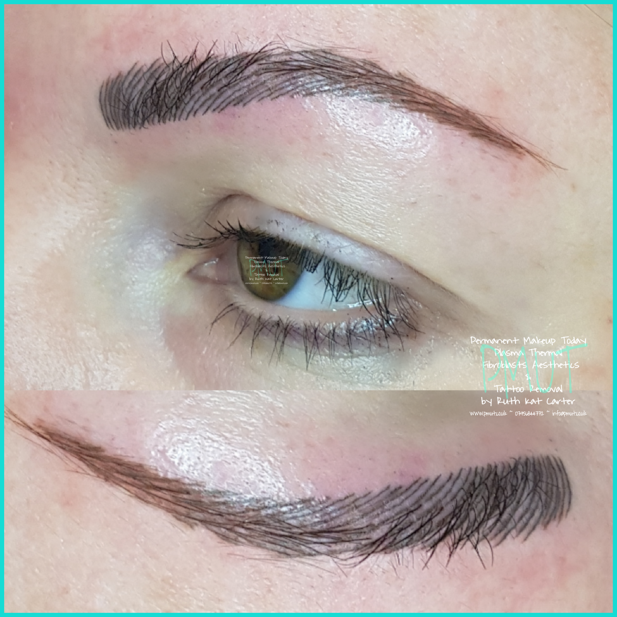 Brows Procedure